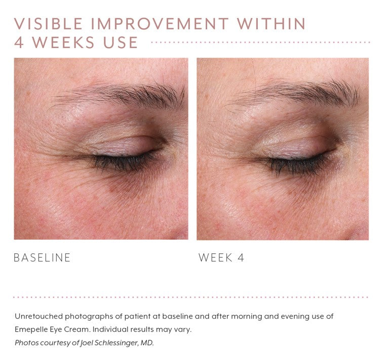emepelle eye cream before and after