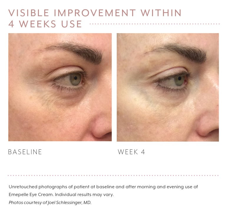 emepelle eye cream ageing skin