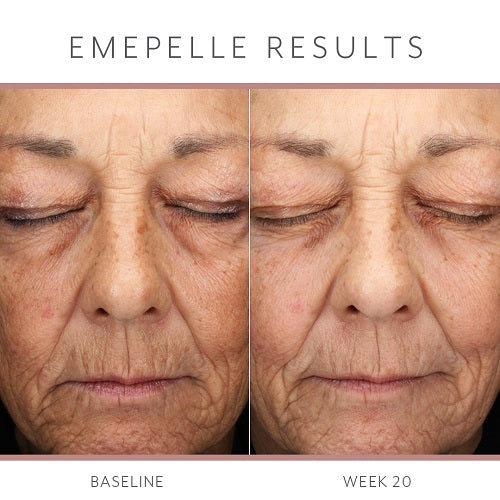 Emepelle Serum